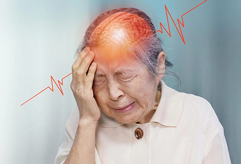 Stroke Prevention Guide: Early Warning Signs and Life-Saving Action Steps